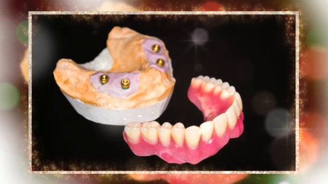 Dental implant clinics