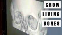 Need A New Bone? Grow It From Your Own Cells