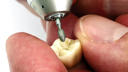 Emerald Dental: Premier Dental Milling Centre with Modern Dental Equipment & Software in Hamilton ON