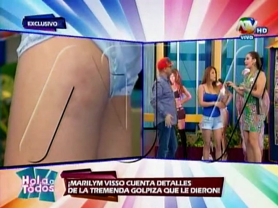 Marylin Visso denuncia que sufrió una agresión