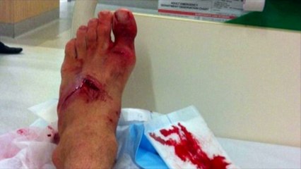 Un surfeur australien échappe au requin qui voulait le dévorer