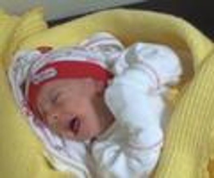 Siyam ikizleri ameliyatla ayrıldı
