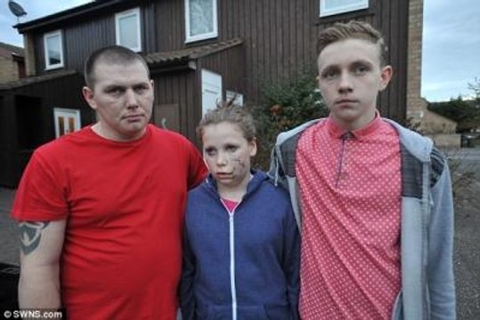 Sibirya Kurdu, Küçük Kızın Yüzünü Parçaladı