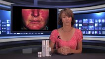 Clinicians Complex Rosacea Kit by Delasco