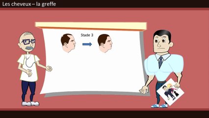 Pour qui la greffe des cheveux ?