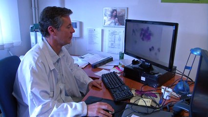 Análisis de sangre detecta cáncer de pulmón