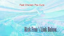 Fast Chicken Pox Cure Free Review (fast chicken pox cure in 3 days 2014)