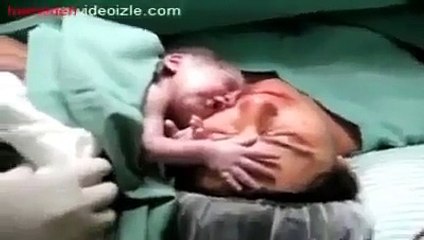 baby that after he born he didn't want to separate from his mom. AMAZING and EMOTIONAL