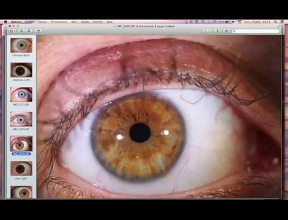 bienêtreaujus cours iridologie1 découvrons l iridologie 2_2-_vivrecru.org