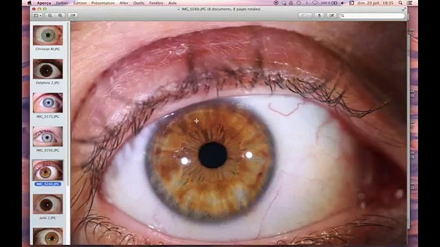 bienêtreaujus cours iridologie2 découvrons l iridologie 1_2-_vivrecru.org