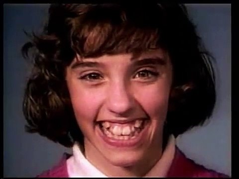 Timelapse d'un ré-alignement de dents réalisé avec un appareil dentaire