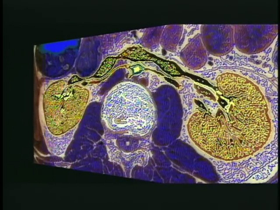 Visible Human Overview
