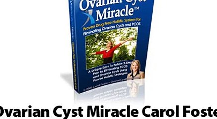 Ovarian Cyst Miracle Carol Foster Review and Coupon