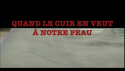 Quand Le Cuir En Veut A Notre Peau