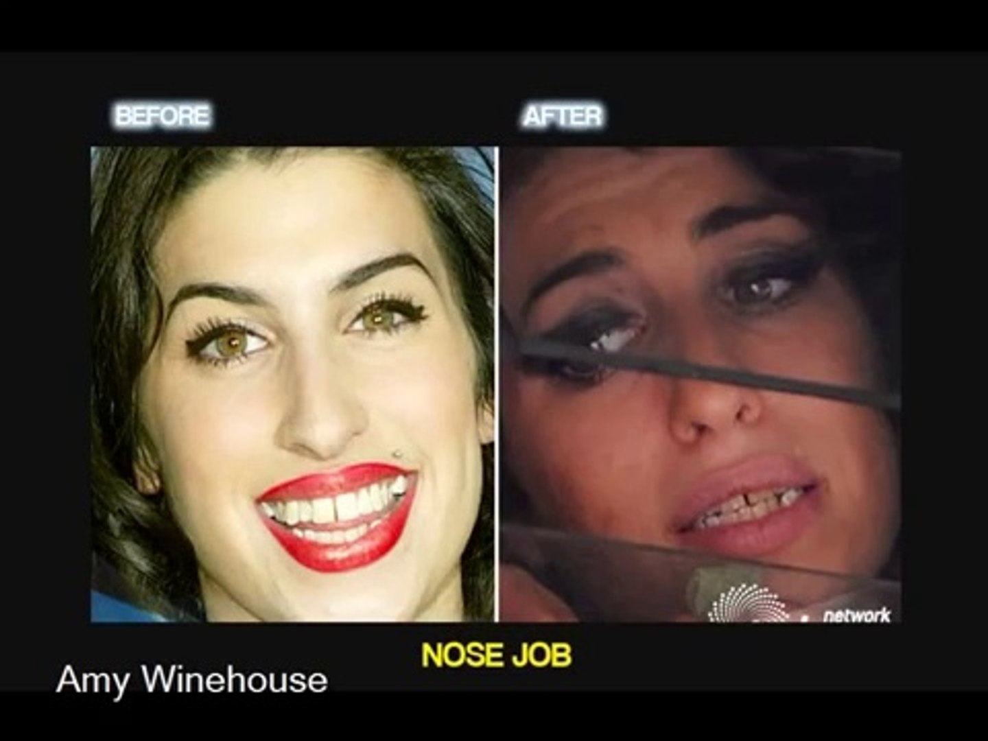Celebrity Plastic Surgery (before and after)