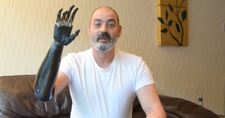 Protez Terminatör Kol!