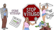 Natural Vitiligo Treatment System - Top Vitiligo Cure