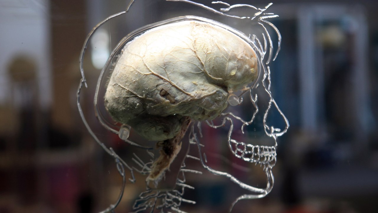 Ex-Wives Rejoice: Science May Be Able To Read Minds Soon