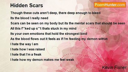 Kevin Fisher - Hidden Scars