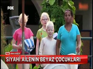 Albino hastalığı yüzünden 3 çocuğu beyaz olan aileye lanetli gözüyle bakılıyor