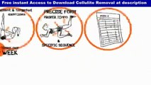 Joey Atlas Symulast PDF - Truth About Cellulite Reviews!