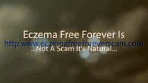 Eczema Free Forever Scam