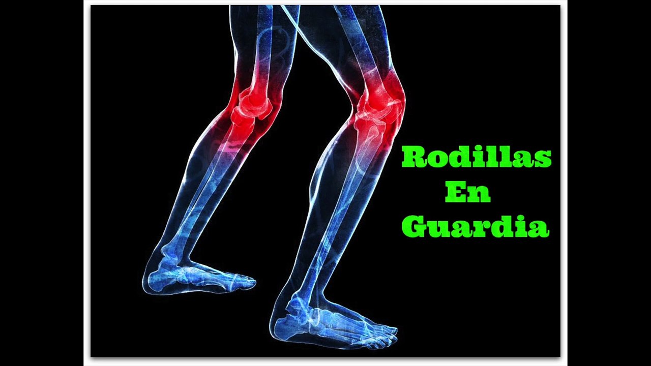 Rodillas en Guardia