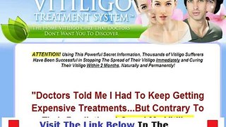 Natural Vitiligo Treatment System Free Ebook + DISCOUNT + BONUS