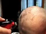 balding clippers closeup