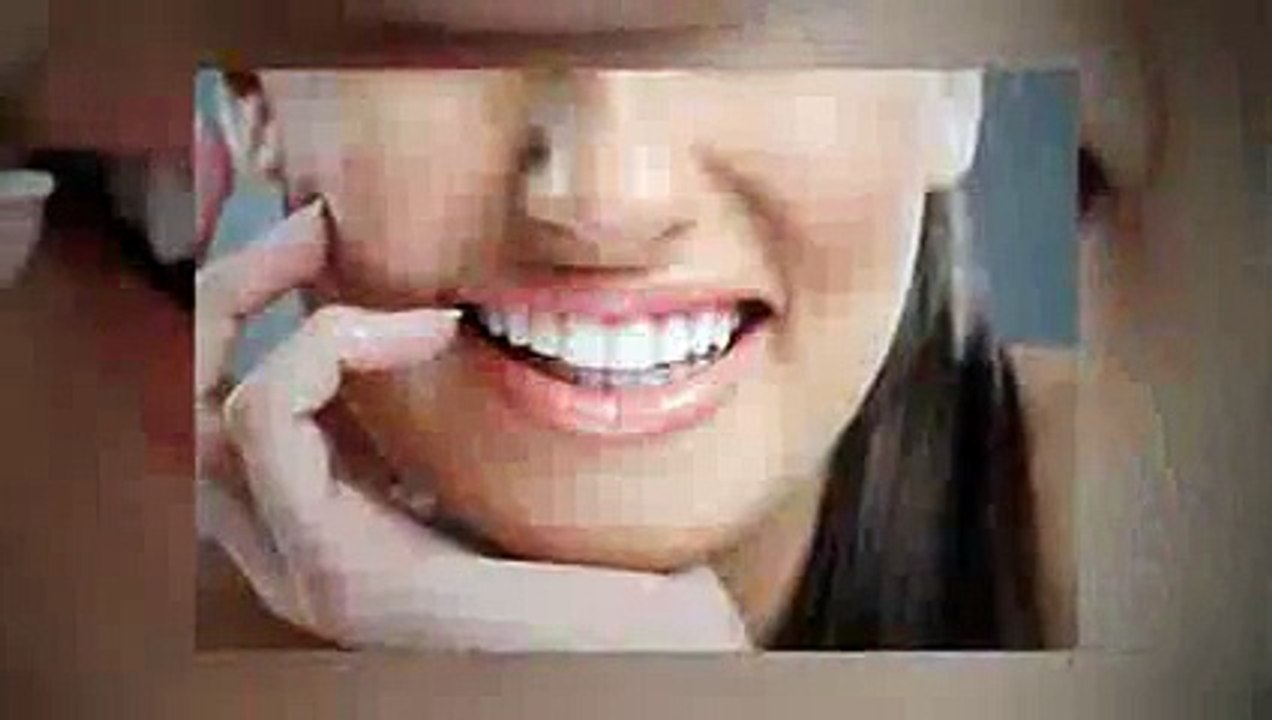 Root Canal Frisco TX - Call 972-335-7666