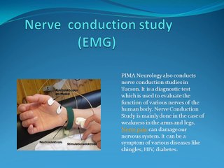 Multiple Sclerosis | Tucson