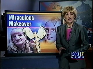 Discovery Channel Documentary on a special patient of Dr. Stephanides