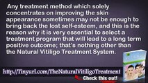 Natural Vitiligo Treatment Book And Natural Vitiligo Treatment