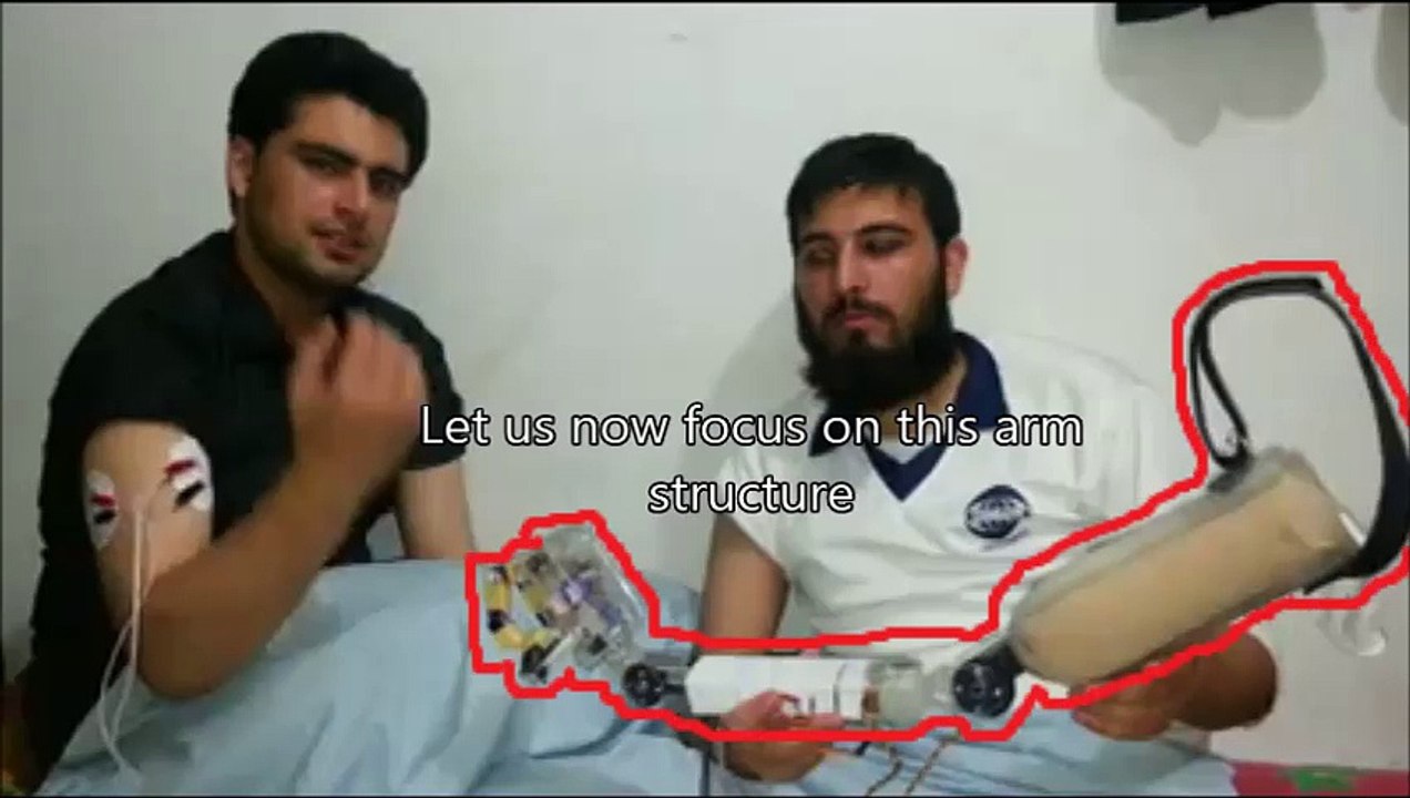 Final Year Project(detection and classification of EMG signals for controlling Prosthetic Arm)