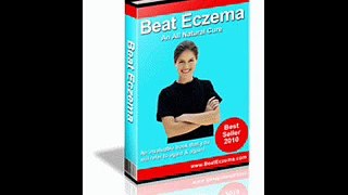 Beat Eczema Review