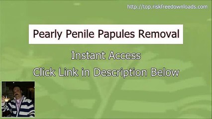 My Pearly Penile Papules Removal Review (plus instant access)