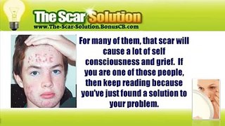 The Scar Solution - Learn the Secret of Permanent Natural Scar Removal