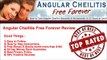 Angular Cheilitis Free Forever  Review - Does Angular Cheilitis Free Forever Work