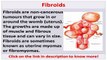See now fibroids miracle