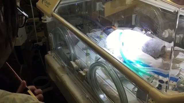 Padre canta a su bebé prematuro que agoniza en una incubadora