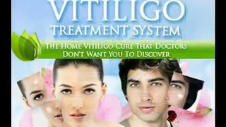 Natural Vitiligo Treatment System eBook Download