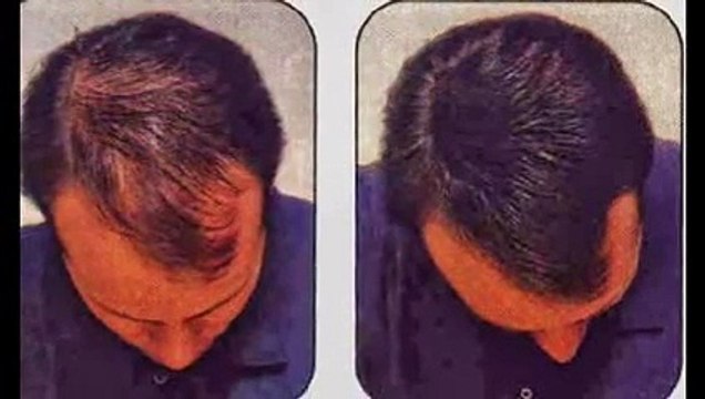 Hair Building Fiber oil at Telle Brand Call ; 03458423444