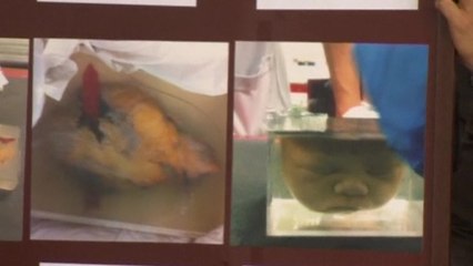 Body parts found in shipping company box