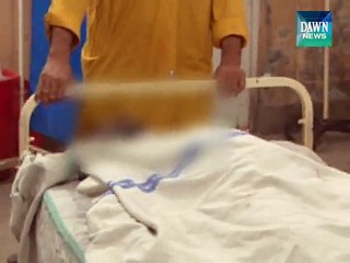 Multan: Students set hotel owner on fire for not serving them free tea