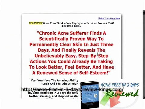 acne free in 3 days treatment reviews