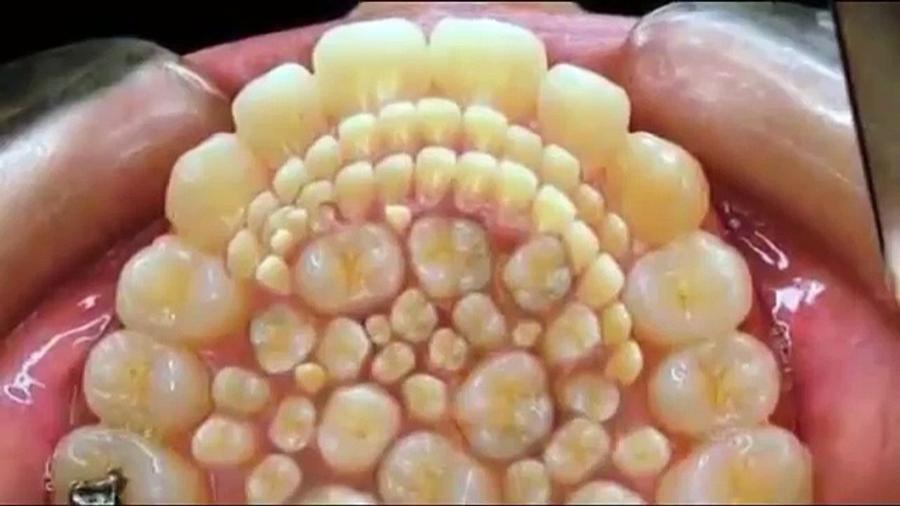 Kid has 232 teeth