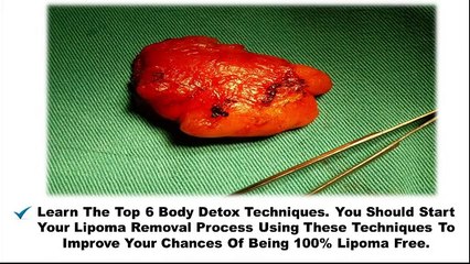 How To Cure Lipoma Naturally