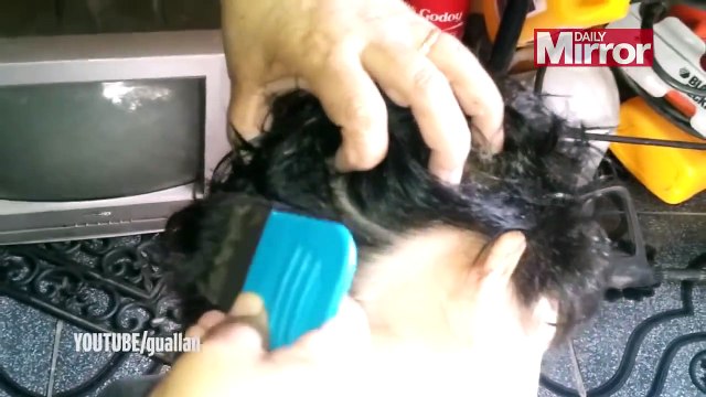 Is this the worst case of head lice ever? Video shows girl infested with HUNDREDS of nits