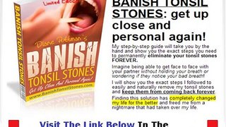 Banish Tonsil Stones Free + DISCOUNT + BONUS