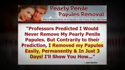 Video herunterladen: Pearly Penile Papules Removal - Review Of Josh Marvin Pearly Penile Papules Removal System